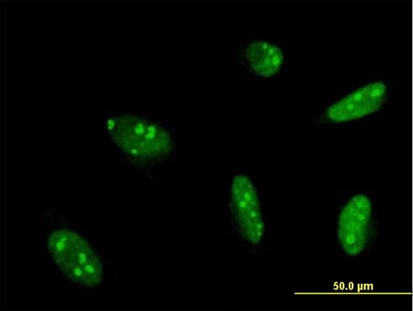 IHC-plus™ MEF2A / MEF2 Antibody (clone 1A10)