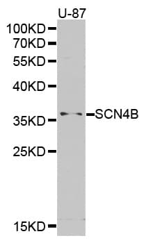 Polyclonal Rabbit anti-Mouse SCN4B Antibody (WB)