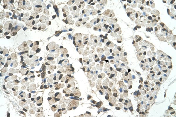 PSD3 Antibody (aa67-116)
