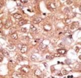 Polyclonal Rabbit anti-Human GDF2 / BMP9 Antibody (aa8-37, IHC, WB)
