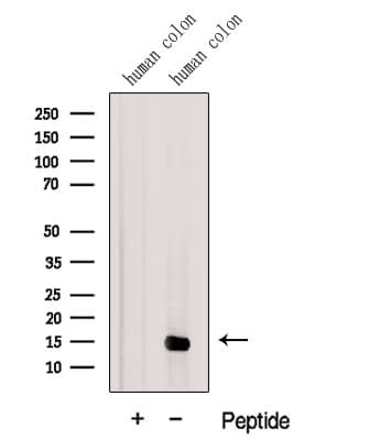 Polyclonal Rabbit anti-Human LGALS2 / Galectin 2 Antibody (WB)