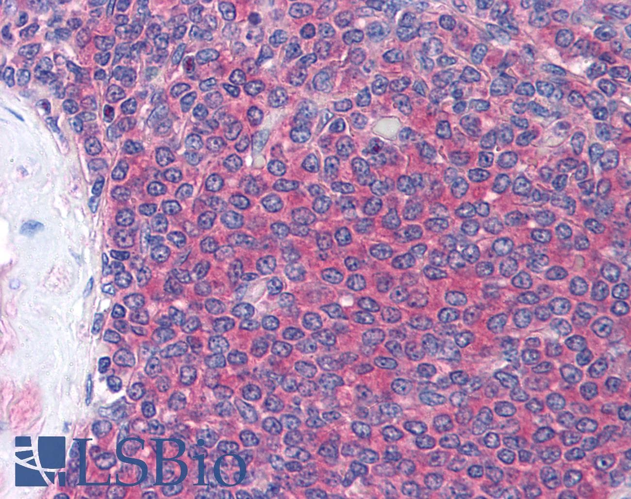 IHC-plus™ Monoclonal Mouse anti-Human p56lck / LCK Antibody (clone Lck-01, IHC, WB)