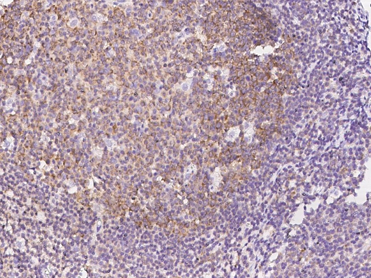 Polyclonal Rabbit anti-Human LSM14A Antibody (IHC, WB)
