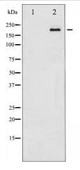 Tuberin / TSC2 Antibody