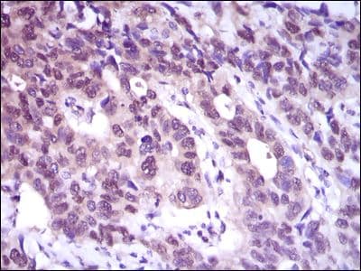 ACLY / ATP Citrate Lyase Antibody (Amino Acid: 306-502, clone 5F8D11)