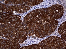 NME1 / NM23 Antibody (clone OTI4G3, Carrier-free)