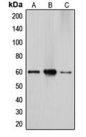 Polyclonal Rabbit anti-Human CYP27 / CYP27A1 Antibody (Internal, IHC, IF, WB)