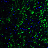 PathPlus™ HES5 Antibody