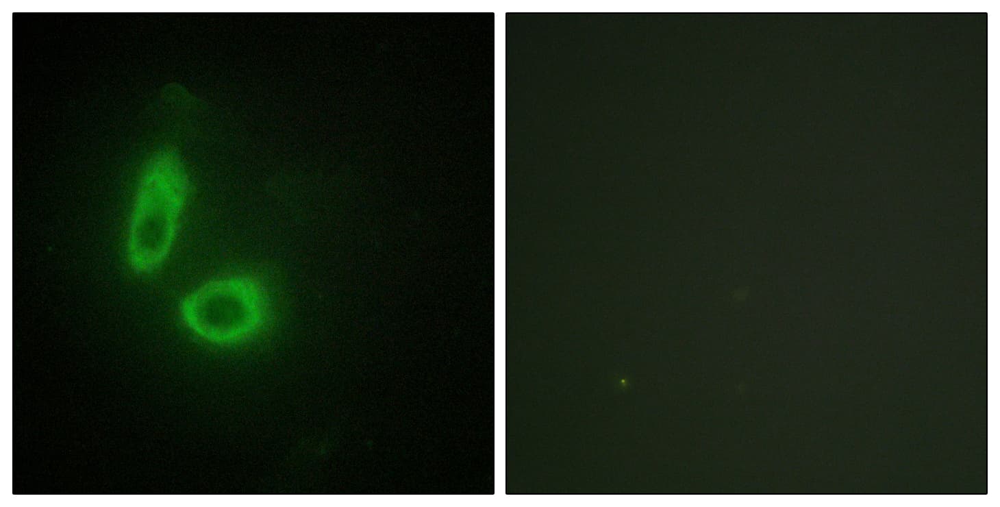 IHC-plus™ EFNA1 / Ephrin A1 Antibody (aa66-115)