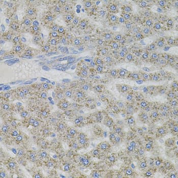 Polyclonal Rabbit anti-Human VIP Antibody (IHC, WB)