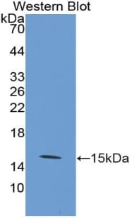 SLC2A1 / GLUT-1 Antibody (aa251-329)