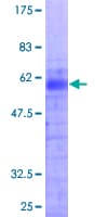 Human HOXB1 Protein (Recombinant GST)