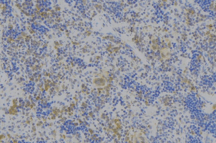 NRP1 / Neuropilin 1 Antibody