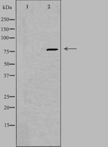 Polyclonal Rabbit anti-Human PIP5K1C Antibody (IF, WB)