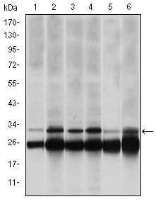 PSMB8 / LMP7 Antibody (clone 1A5)
