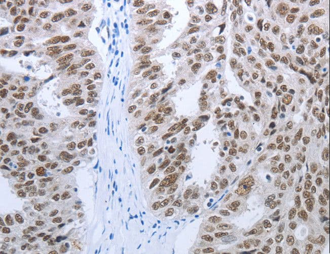 RBMS1 Antibody