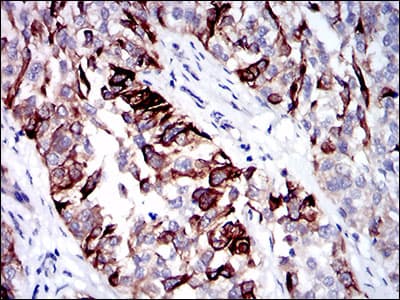KRT5 / CK5 / Cytokeratin 5 Antibody (aa316-590, clone 10C11E6)