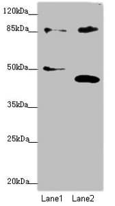 Polyclonal Rabbit anti-Human TAF5 Antibody (IHC, WB)