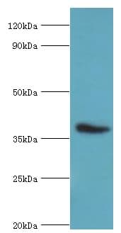 CD84 / SLAMF5 Antibody (aa22-225)
