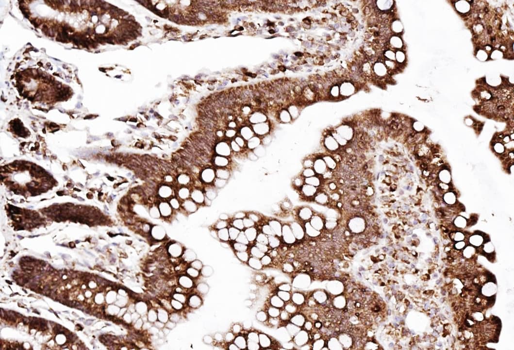 Polyclonal Rabbit anti-Human SSR3 / TRAP-Gamma Antibody (aa8-23, IHC, WB)