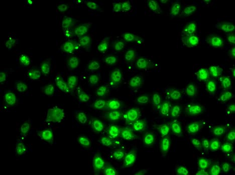 GABPB1 Antibody