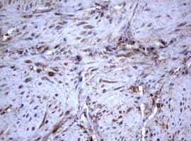 CD30 Antibody (clone OTI16H5)
