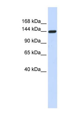 DAAM1 Antibody (aa396-445)