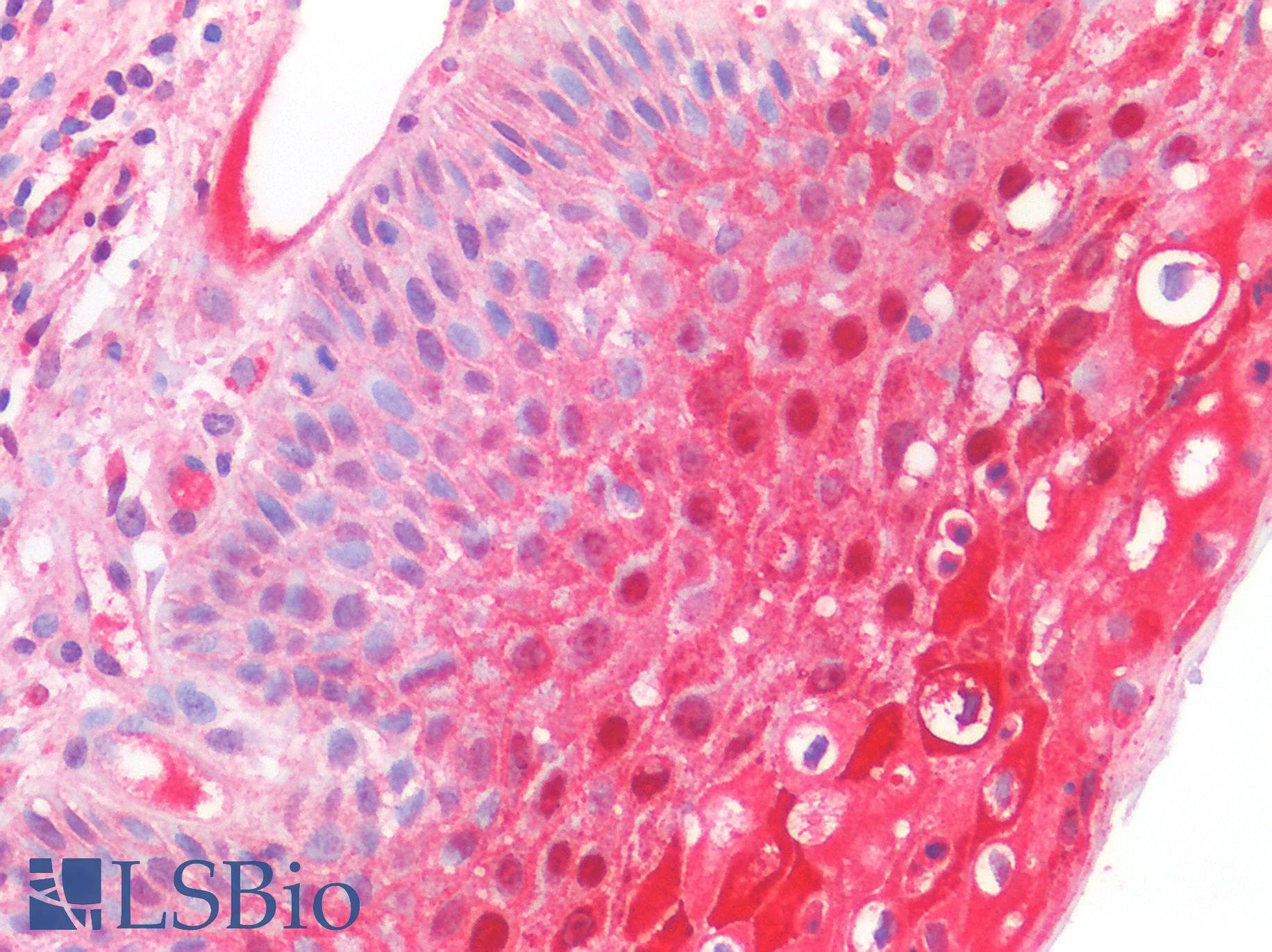 IHC-plus™ CSTA / Cystatin A Antibody