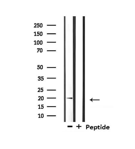 Polyclonal Rabbit anti-Human SCGB2A2 / Mammaglobin A Antibody (IHC, IF, WB)
