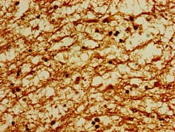 POU3F1 / OCT6 Antibody
