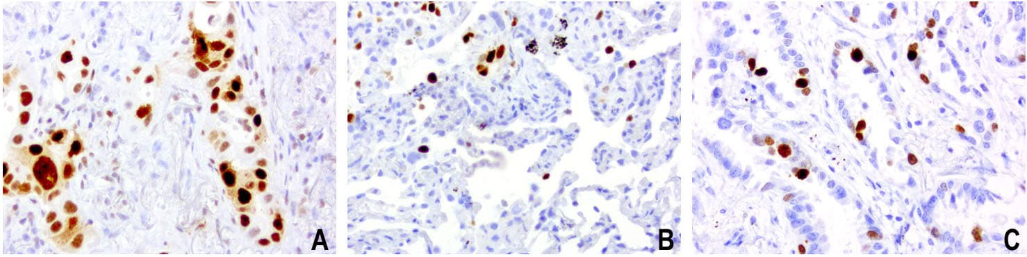 MKI67 / Ki67 Antibody (aa1160-1493, clone UMAB107, Carrier-free)