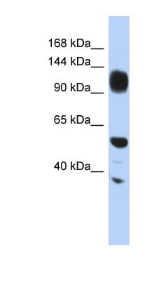 WDHD1 Antibody (aa611-660)