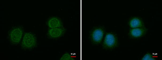 IHC-plus™ Polyclonal Rabbit anti-Human SPINK1 Antibody (Internal, IHC, IF)