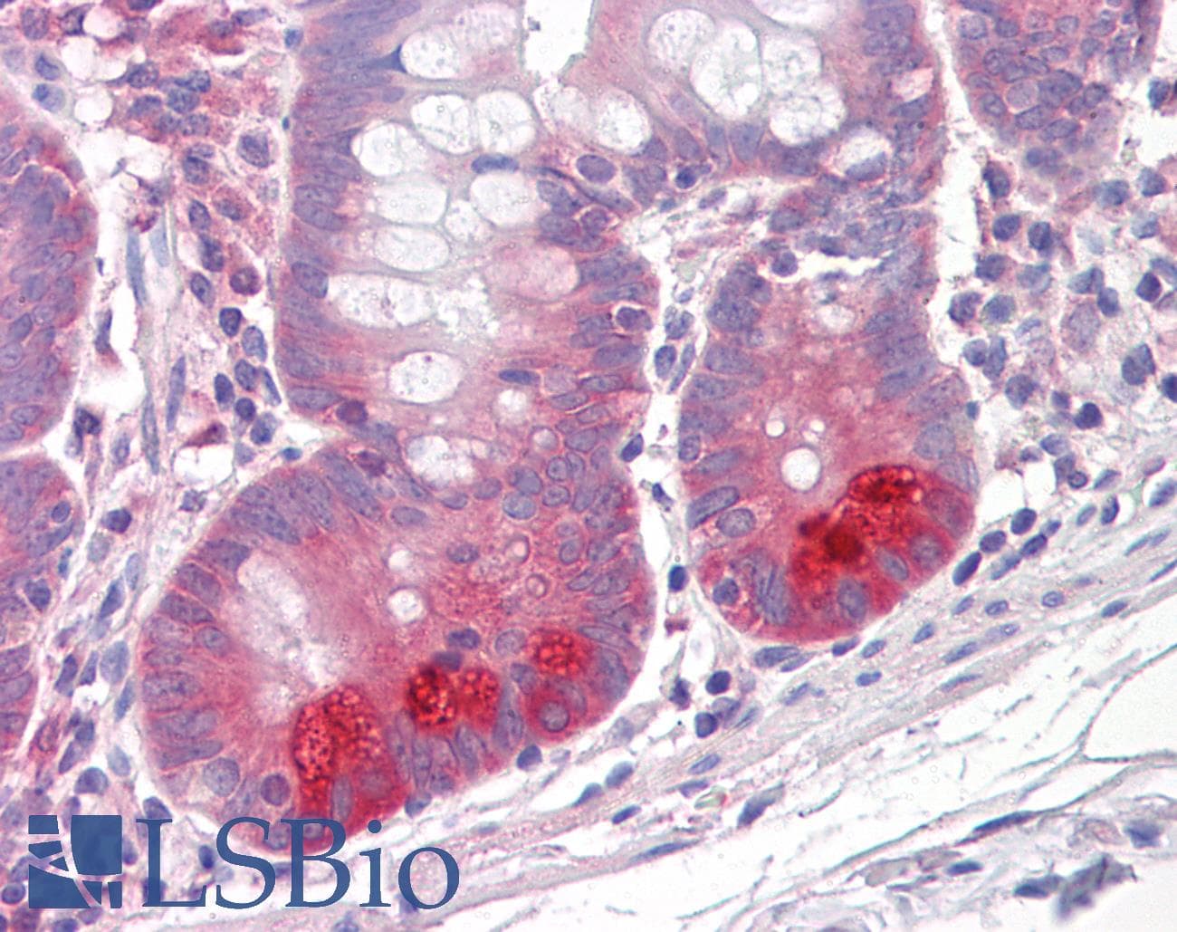 IHC-plus™ PKP3 / Plakophilin 3 Antibody (clone 23E3/4)