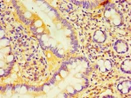 DCP2 Antibody (aa1-240)