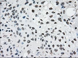 Monoclonal Mouse anti-Human PMEL / SILV / gp100 Antibody (clone OTI10E5, IHC, IF, WB)