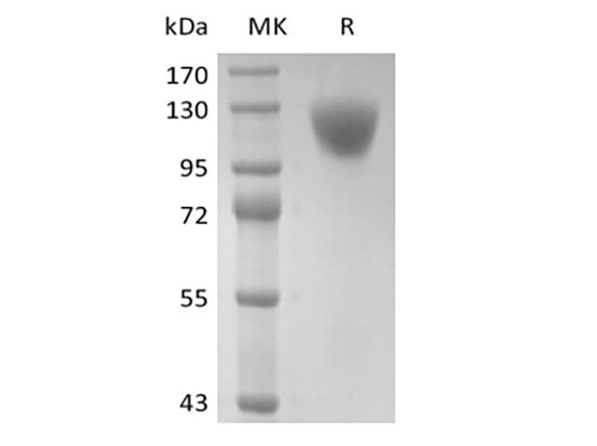 Human CD45 / LCA Protein (Recombinant 6His, C-terminus)