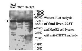 Polyclonal Rabbit anti-Human ZNF471 Antibody (aa24-221, IHC, WB)