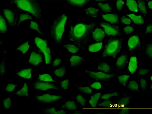 IHC-plus™ Monoclonal Mouse anti-Human RRM2 Antibody (clone 1E1, IHC, IF, WB)