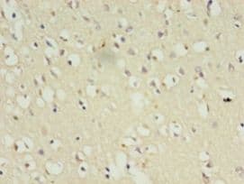 CDK5 Antibody (aa1-292)