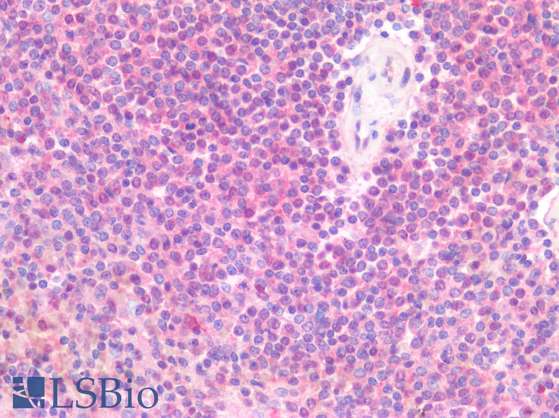 IHC-plus™ TLR8 Antibody