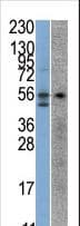 STK38 Antibody (aa410-439)