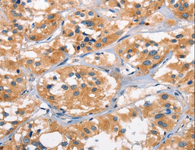 AHR Antibody