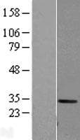 CA1 / Carbonic Anhydrase I Protein (Over-Expression Lysate Myc-DDK (Flag))