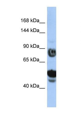 Polyclonal Rabbit anti-Human SPG15 / ZFYVE26 Antibody (aa37-86, WB)