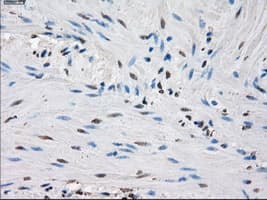 IDH1 / IDH Antibody (clone OTI2H9)