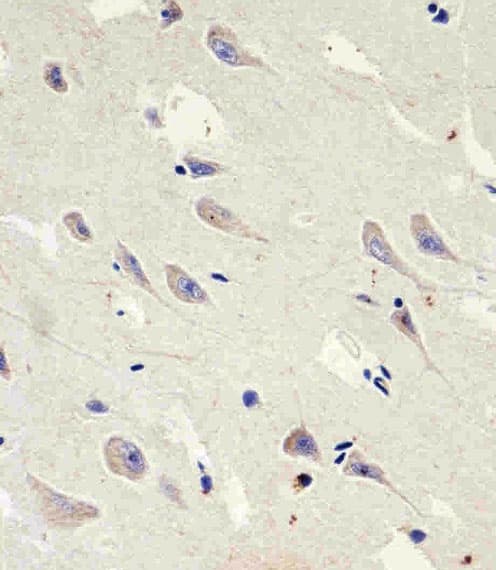 Polyclonal Rabbit anti-Human GLS2 / Glutaminase 2 Antibody (aa498-524, IHC, WB)