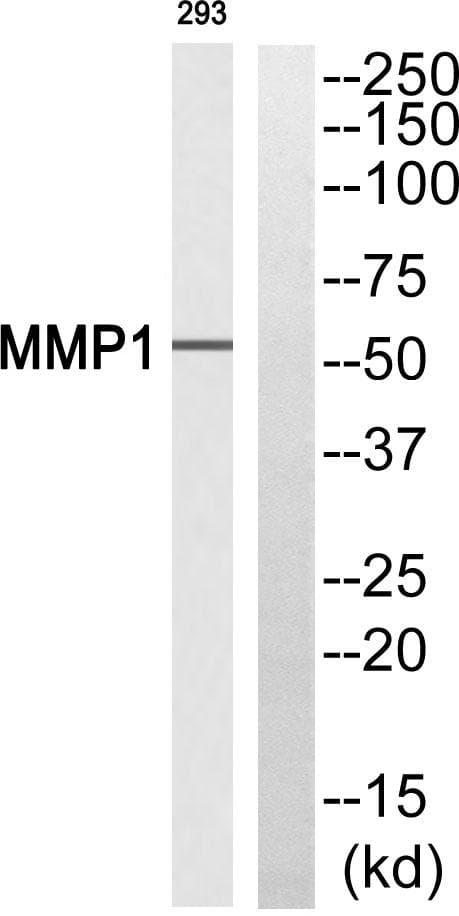 MMP1 Antibody (Cleaved-Pro269)