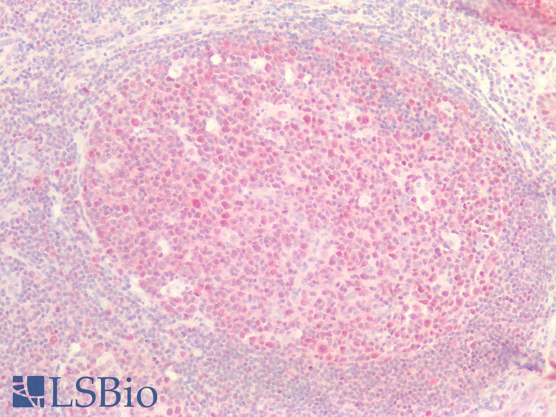 IHC-plus™ FEN1 Antibody (aa117-380, clone OTI1E1)