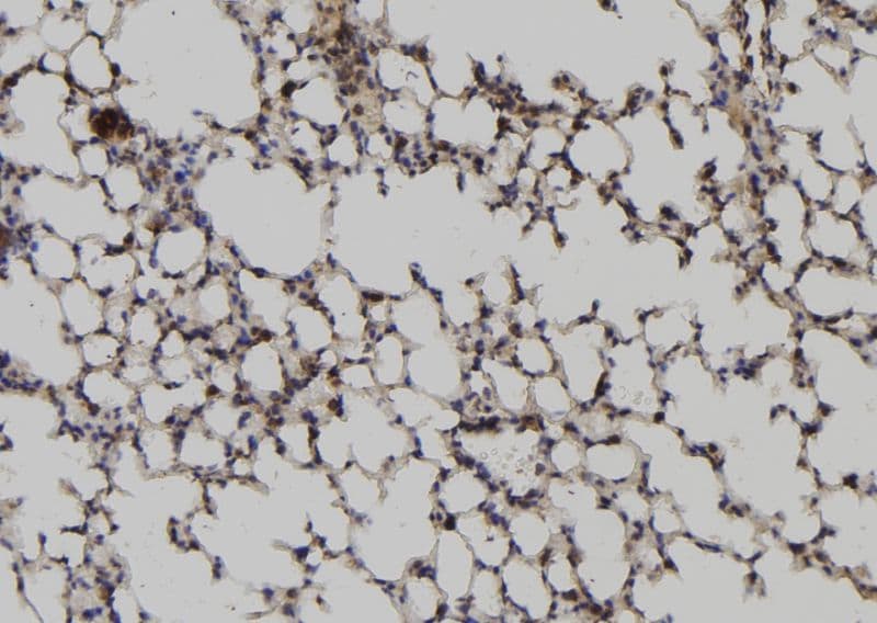RGS2 Antibody